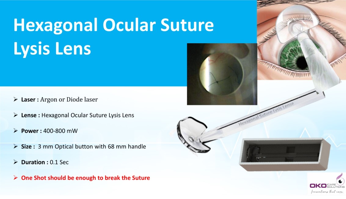 Hexagonal Ocular laser suture lysis lens